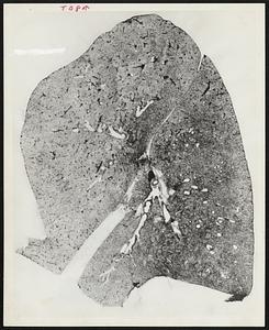 Undiseased human lung