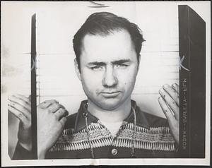 Robert E. Campbell displays injuries to his fingers