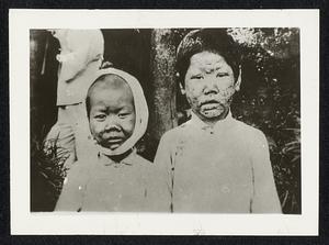 At the Maryknoll Leper Colony, Sunwui, South China