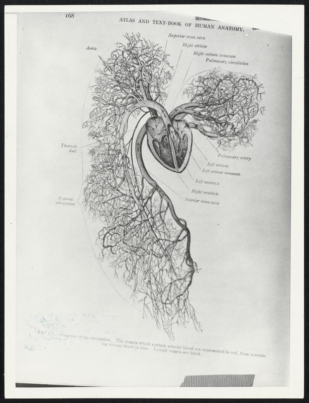 Diagram of the circulation. The vessels which contain artificial blood are represented in red, those containing venous blood in blue. Lymph vessels are black.