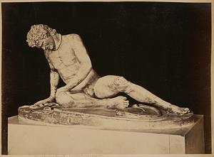 The dying Gaul - Capitoline, Rome