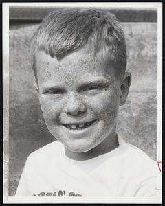 Freckles Grower - For raising this flourishing crop of freckles Kevin McCarthy, 9, of 817 Dorchester Ave., Dorchester, won first prize at the annual freckle contest of the South Boston Boys Club. The freckle-faces paraded their wares at the playground of the Charles Hayden Memorial Clubhouse yesterday.