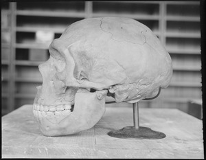 Labeled skull
