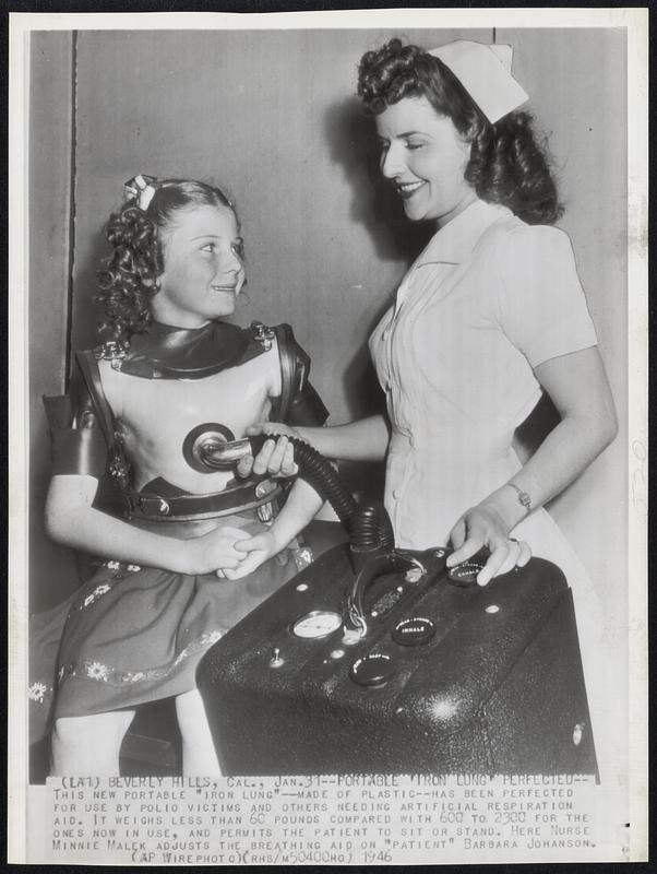 Portable 'Iron Lung' Perfected--This new portable "Iron Lung"--made of plastic--has been perfected for use by polio victims and others needing artificial respiration aid. It weighs less than 60 pounds compared with 600 to 2300 for the ones now in use, and permits the patient to sit or stand. Here Nurse Minnie Malek adjusts the breathing aid on "patient" Barbara Johanson.