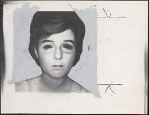 The battered Maureen Bridges after the assault