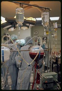 Autotransfusion at Massachusetts General Hospital liver operation, Boston