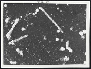 Asian Flu - This is what the Asian Flu virus looks like when its magnified about 130,000 times. Viruses have different shapes but all are potent. Picture was taken by Dr. Richard E. Hartman of the Walter Reed Army Institute of Research in Washington.