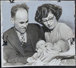 Two headed baby and parents