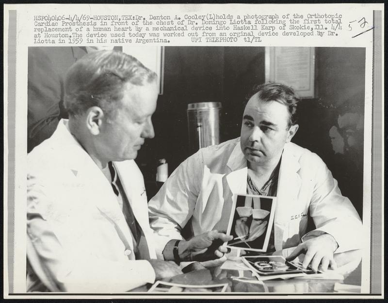 Dr. Denton A. Cooley (L) holds a photograph of the Orthotopic Cardiac Prosthesis in front of the chest of Dr. Domingo Liotta following the first total replacement of a human heart by a mechanical device into Haskell Karp of Skokie, Ill. 4/4 at Houston. The device used today was worked out from an original device developed by Dr. Liotta in 1959 in his native Argentina.