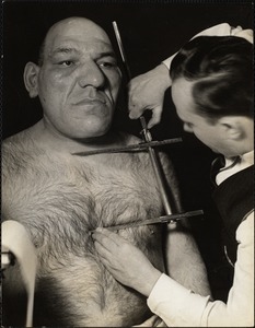 Dr. Seltzer measuring height of sternum