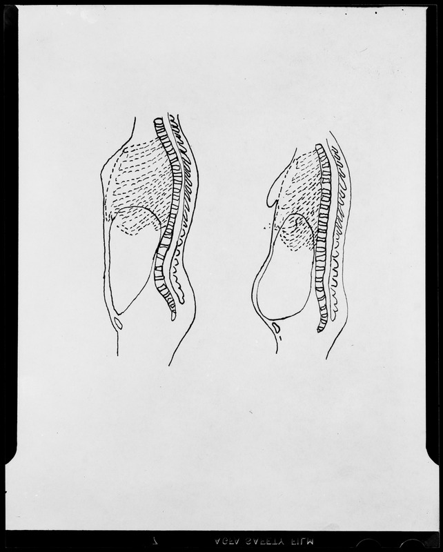 Do/More Chairs advertisement, diagram showing two torsos in profile