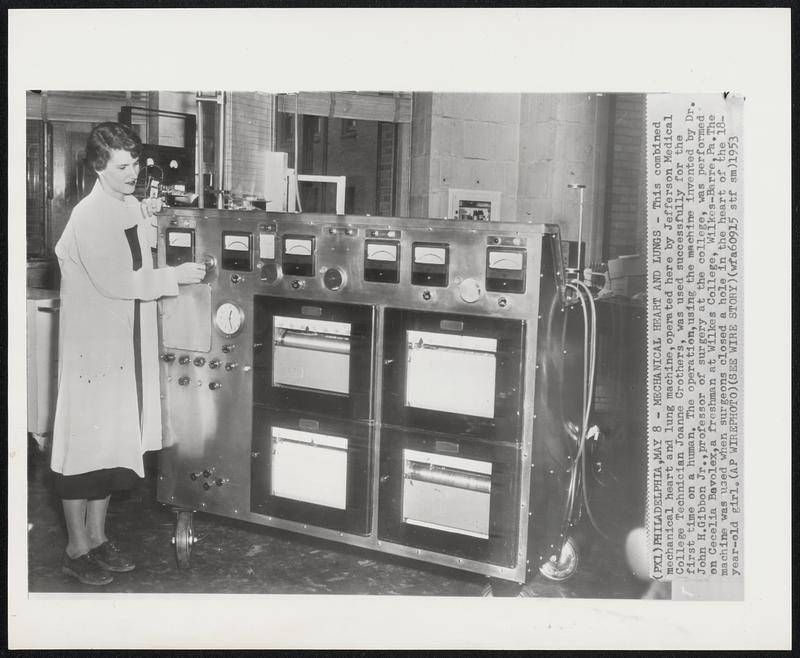Mechanical Heart and Lungs - This combined mechanical heart and lung machine, operated here by Jefferson Medical College Technician Joanne Crothers, was used successfully for the first time on a human. The operation, using the machine invented by Dr. John H. Gibbon Jr., professor of surgery at the college, was performed on Cecelia Bavolex, a freshman at Wilkes College, Wilkes-Barre, Pa. The machine was used when surgeons closed a whole in the heart of the 18-year-old girl.