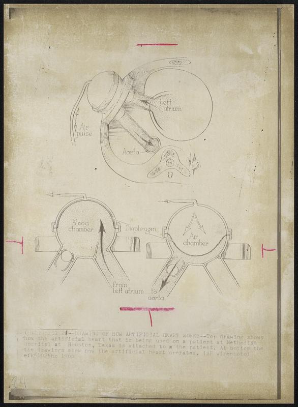 Drawing of How Artificial Heart Works--Top drawing shows how the artificial heart that is being used on a patient at Methodist Hospital at Houston, Texas is attached to the patient. At bottom the drawings show how the artificial heart operates.