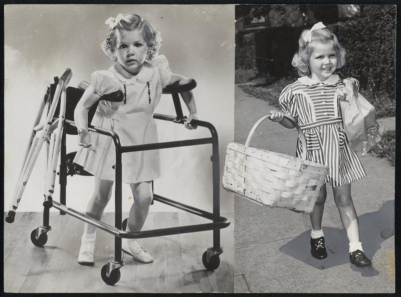 Polio "Poster Girl" this year is 4-year-old Nancy Drury, who was selected from hundreds of children who have recovered from infantile paralysis. Treatment such as the Louisville, Ky., youngster is shown having at left restored her health.
