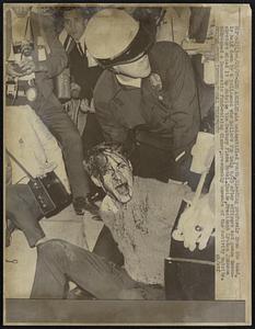 An unidentified youth, bleeding profusely from the head, is held down by a policemen who hollers for help 6/23 after officers and peace demonstrators mixed it up outside the Century Plaza Hotel. Inside, President Lyndon Johnson addressed a Democratic fund-raising dinner, presumably unaware of the activity outside.