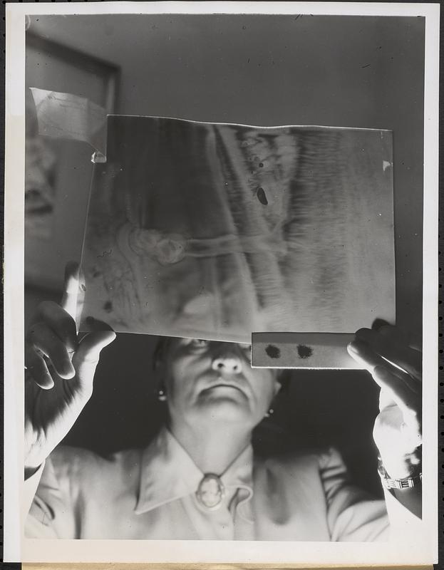 X-ray diagnosis by remote control