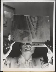 X-ray diagnosis by remote control