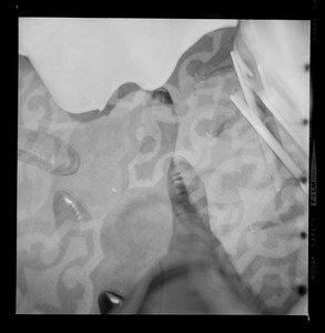 View of shoes on a carpet