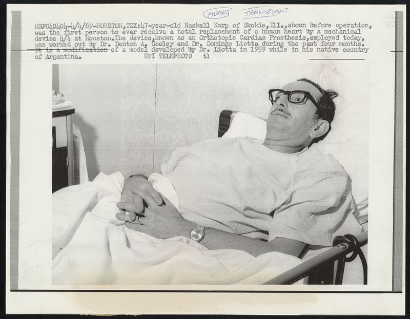 47-year-old Haskell Karp of Skokie, Ill., shown before operation, was the first person to ever receive a total replacement of a human heart by a mechanical device 4/4 at Houston. The device, known as an Orthopedic Cardiac Prosthesis, employed today, was worked out by Dr. Denton A. Cooley and Dr. Domingo Liotta during the past four months. It is a modification of a model developed by Dr. Liotta in 1959 while in his native country of Argentina.