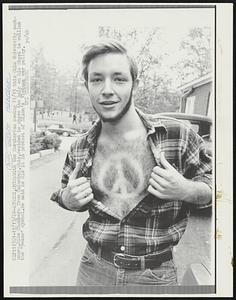 With the Moratorium coming 11/15 the Ohio University sophomore,Mike Chambers from Columbus,Ohio,decided to shave the hair on his chest to outline the “peace” symbol.He said he did it in protest of Nixon’s Vietnam war policy.