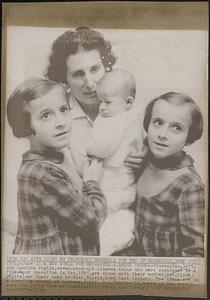 A new world for separated Siamese twins