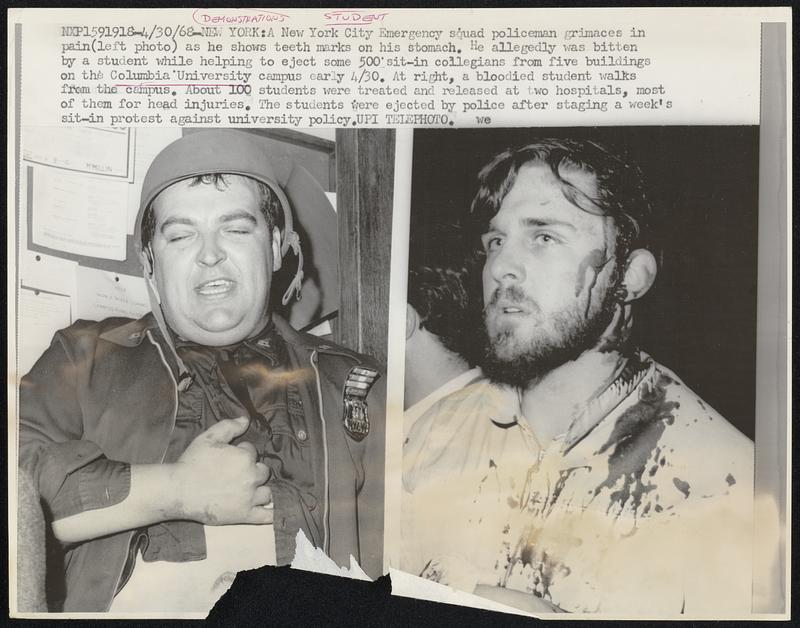 New York: A New York City Emergency squad policeman grimaces in pain (left photo) as he shows teeth marks in his stomach. He allegedly was bitten by a student while helping to eject some 500 sit-in collegians from five buildings on the Columbia University campus early 4/30. At right, a bloodies student walks from the campus. About 100 students were treated and released at two hospitals, most of them for head injuries. The students were ejected by police after staging a week's sit-in protest against university policy.