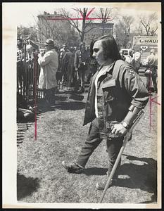 Unidentified Army veteran walks with aid of crutches at anti-war rally on Common.