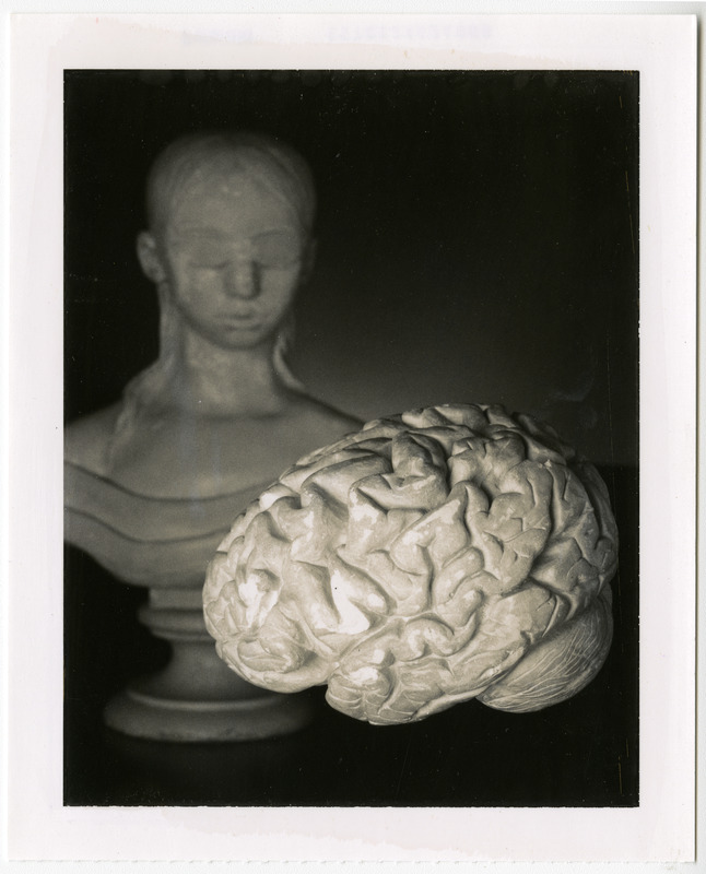 Photograph of Laura Bridgman's bust statue and brain model