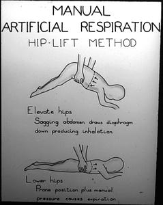 Artificial respiration (early days)