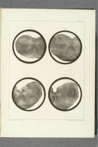 [Photolithographs in The gray substance of the medulla oblongata and trapezium]