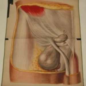 Teaching watercolor of femoral and inguinal hernias, after J. Lebaudy's The Anatomy of the Regions Interested in the Surgical Operations Performed upon the Human Body, 1848-1854