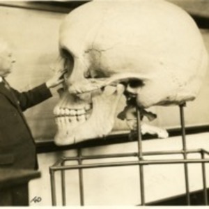 Harris P. Mosher with the teaching skull