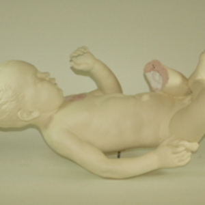 Dickinson-Belskie model of "Bates Baby", 1939-1950