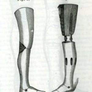 "The Douglass patent artificial limbs."