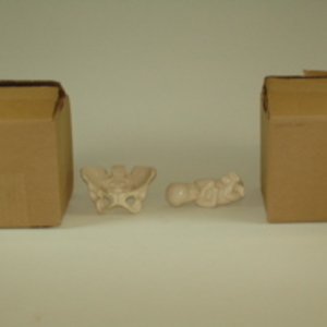 Dickinson-Belskie style fetus and pelvis figurines, circa 1982