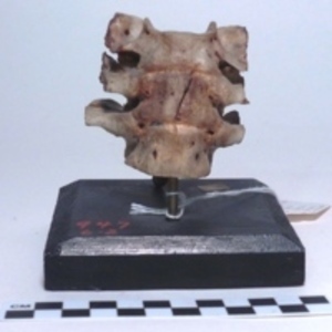 Thoracic vertebra with cut-mark