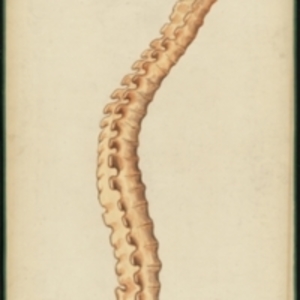 Teaching watercolor of ankylosis and curve of the spine as found in an elderly individual