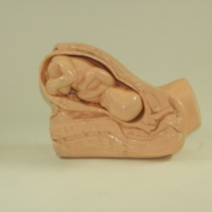Model of fetus in uterus, 1945-2007