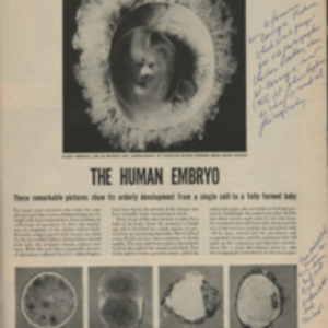 The Human Embryo