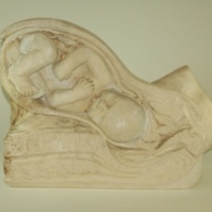 Dickinson-Belskie model of Birth Series nine, 1939