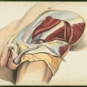 Teaching watercolor of the posterior wall of the inguinal canal