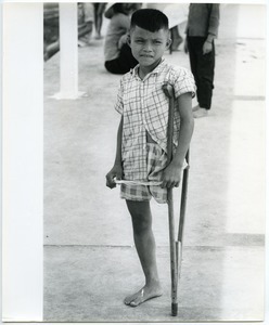 Young boy with one leg