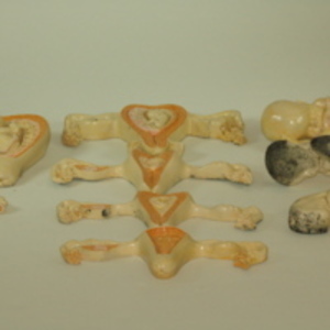 Dickinson-Belskie style embryo models teaching set, 1945-2007