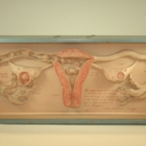 Dickinson-Belskie style uterus display model, 1945-2007