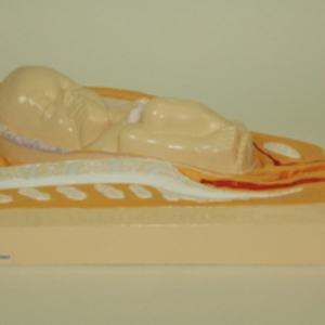 Replica of Dickinson-Belskie model of fetus in uterus, 1967