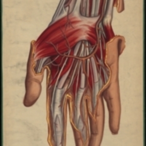 Teaching watercolor of a surgical dissection of the wrist and palm