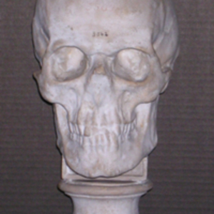 Phrenology cast of skull of Johann Gaspar Spurzheim, 1848