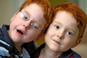 Red headed twins William and Joseph Oliveira, born prematurely on Sept. 5, 2003, at 24th weeks