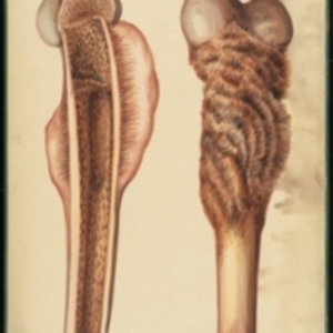 Teaching watercolor of bone with abnormal texture