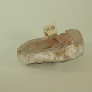 Dickinson-Belskie partial pelvis mold, 1939-1950